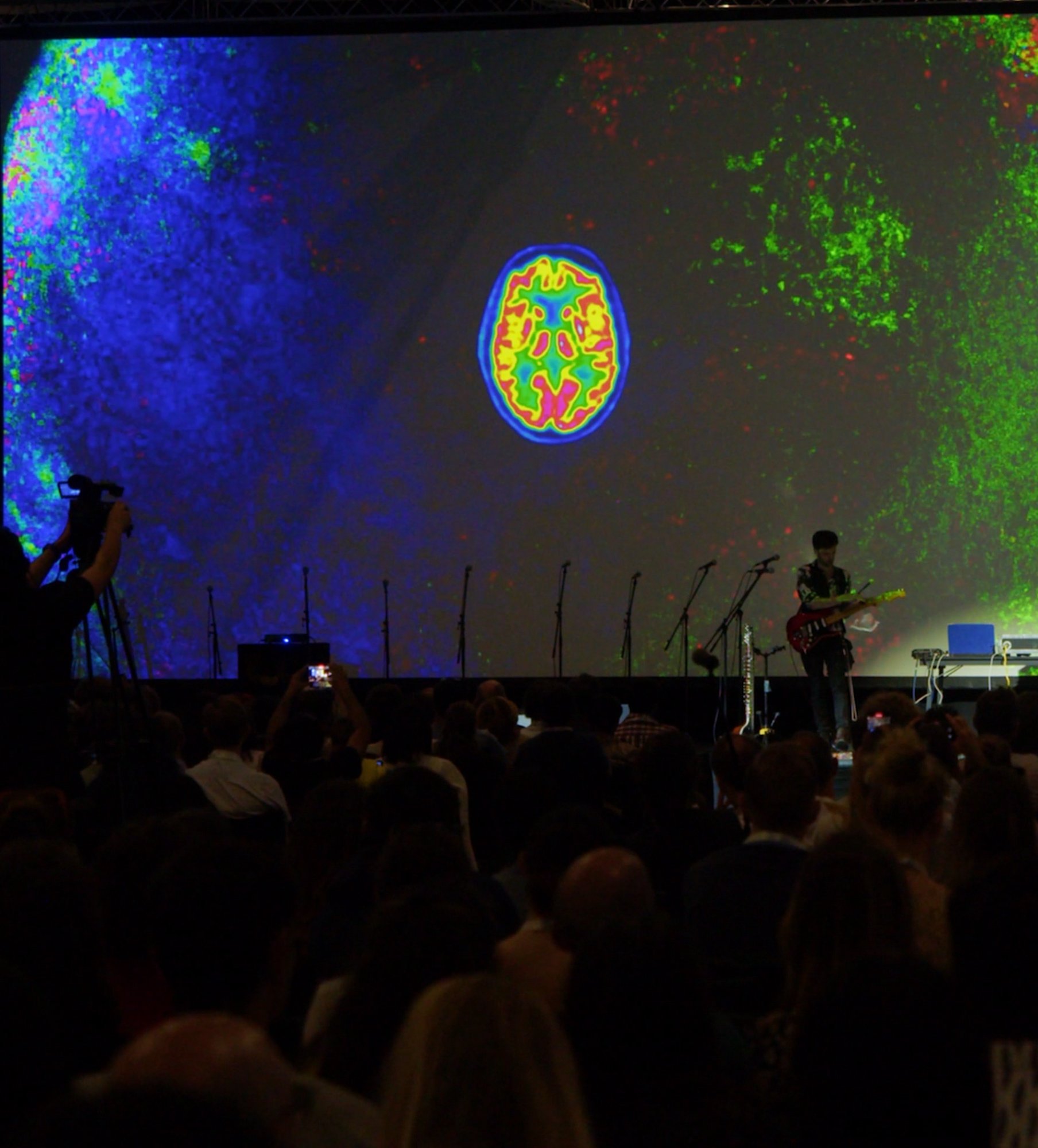 FENS show with brain scan projection